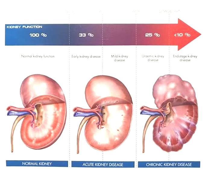 kidney disease dog veterinary