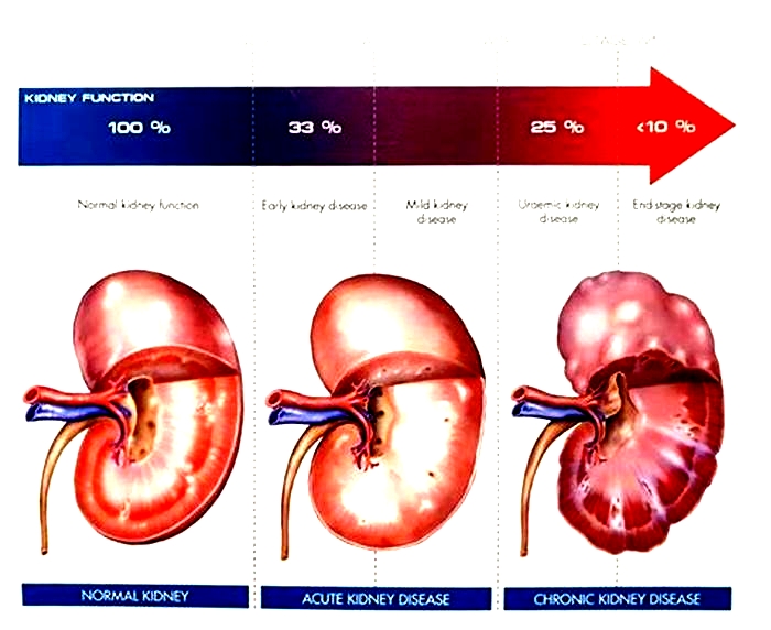 kidney disease in dogs loss of appetite