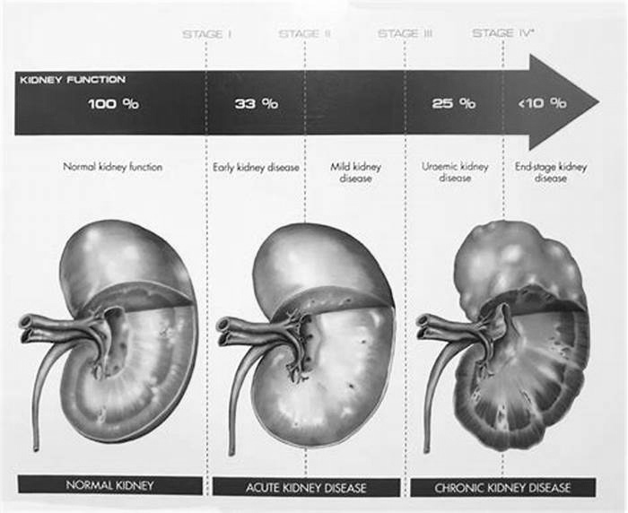 kidney disease on dogs